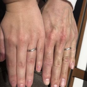 【エクセルコダイヤモンド(EXELCO DIAMOND)の口コミ】 指の節が目立たない、ふっくらした指がコンプレックスだったのですが、そ…