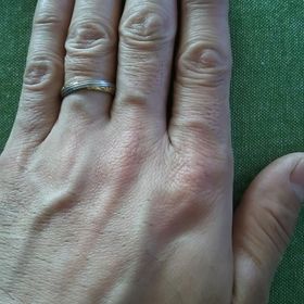 【LAPAGE(ラパージュ)の口コミ】 ごつごつして節が張った自分の指をスッキリ見せてくれるデザインが気に入…