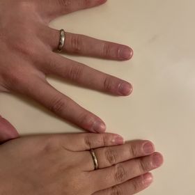 【アイプリモ(I-PRIMO)の口コミ】 指が短くて、太いのがコンプレックスだったんですが、お店の方との相談で…