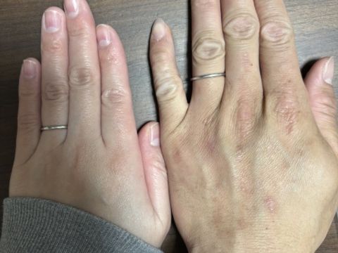 【アイプリモ(I-PRIMO)の口コミ】 細身のタイプでとてもシンプルなデザインです。
キラっと光るさりげないダ…