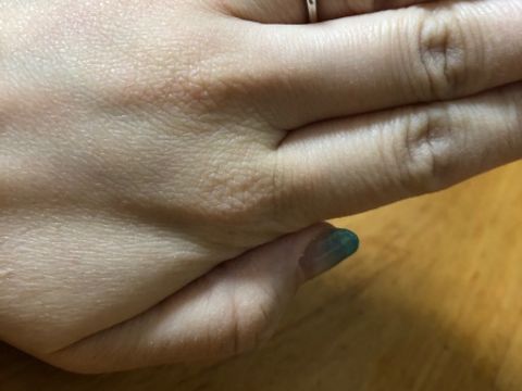 【カルティエ(Cartier)の口コミ】 指輪のデザインは「ザ・婚約指輪」というものにしまいした。とてもダイヤ…