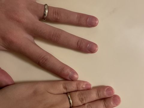 【アイプリモ(I-PRIMO)の口コミ】 指が短くて、太いのがコンプレックスだったんですが、お店の方との相談で…