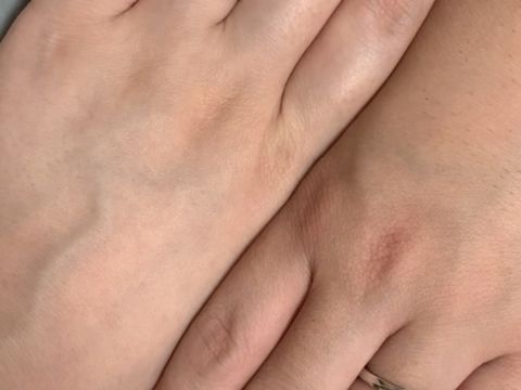 【アイプリモ(I-PRIMO)の口コミ】 一生物になるので、つけ心地、強度も考えましたし、なるべく外したくない…