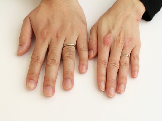 細やかなこだわりがひかる結婚指輪