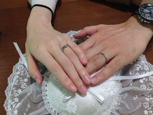 アレルギー懸念の少ない金属を使っている