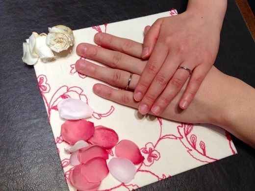 金属アレルギーが起こりにくい素材であったこと。