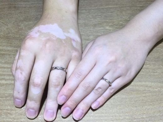 【大分店】種類が豊富！