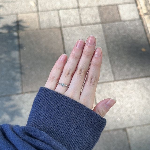 【BIJOUPIKO(ビジュピコ)の口コミ】 パートナーがたくさんの人に相談し、お勧めしていただいたそうです!アーム…