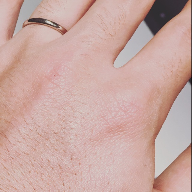 【銀座ダイヤモンドシライシの口コミ】 結婚指輪anolyuの意味にまず惹かれました。素晴らしく素敵な意味合いで真…