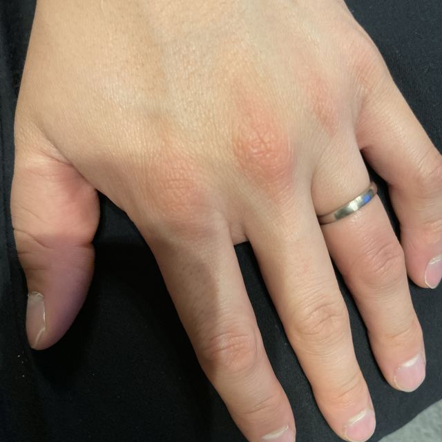 【FISCHER(フィッシャー)の口コミ】 長く使うので、耐久性が高い指輪を探していたところに、ご紹介頂きました…
