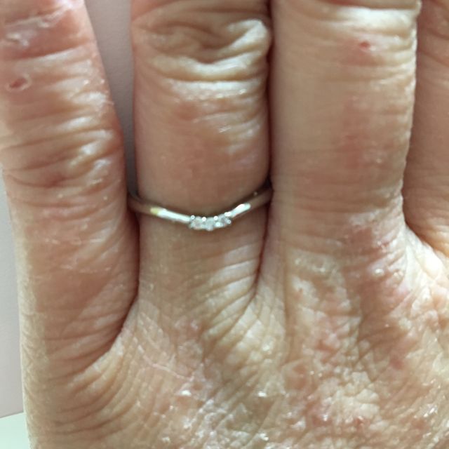 【アイプリモ(I-PRIMO)の口コミ】 指輪のはできるだけ細くて、厚さも薄いものがよくその点が気に入ったのと…