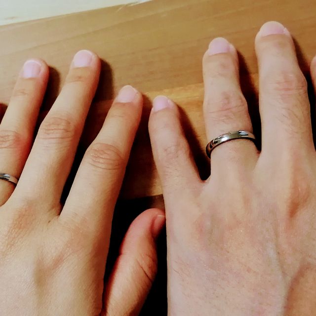 【SORA(ソラ)の口コミ】 金属アレルギーが出るかもしれなかったため、体によい素材で作られた指輪…