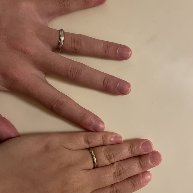 【アイプリモ(I-PRIMO)の口コミ】 指が短くて、太いのがコンプレックスだったんですが、お店の方との相談で…